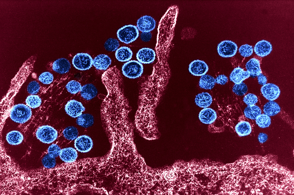 Smrtící virus na palubě: Výletní loď u Kapverd se změnila v past, tři pasažéři zemřeli