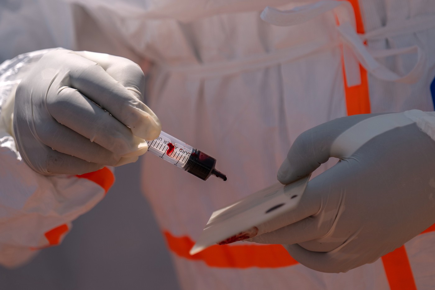 Počet potvrzených případů eboly v Kongu vzrostl na 710, téměř 150 lidí zemřelo
