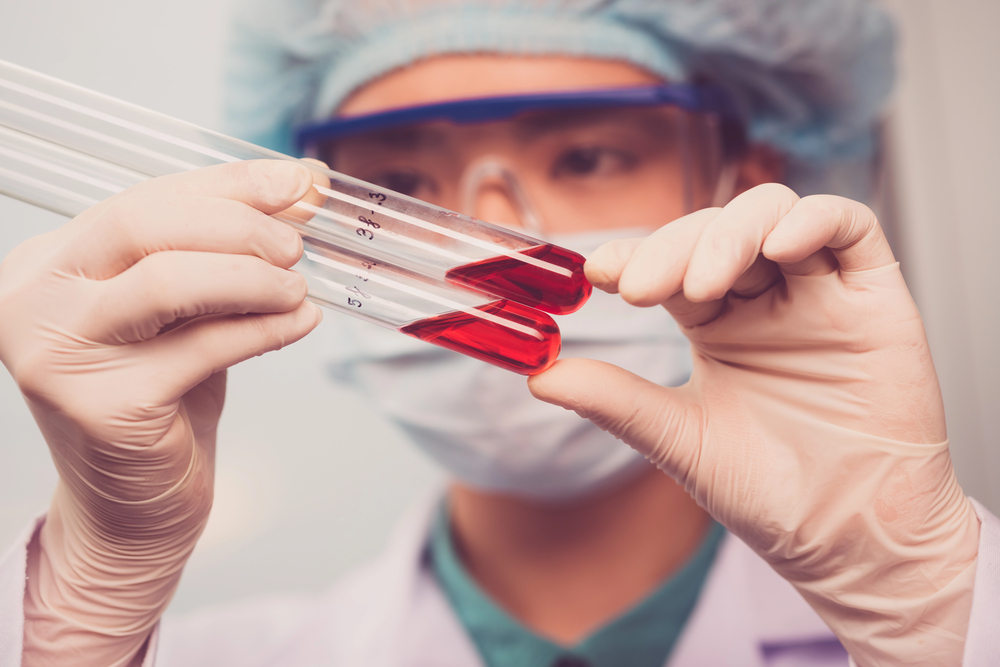 Počet potvrzených případů eboly v Kongu stoupl na 1274, úmrtí je 360
